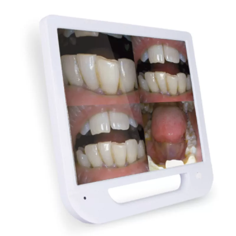 DA-MC01 Intraoral Endoscope | Wide 17'' HD Display | Enhances Dental Diagnostic Efficiency