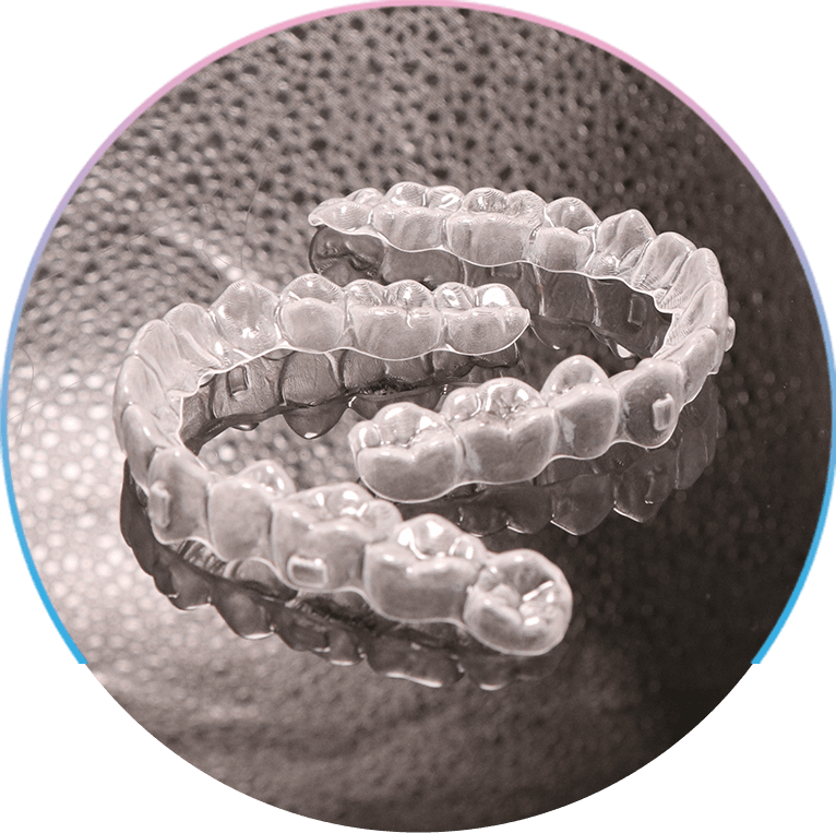 Advanced Version Crossbite Treatment with Braces in Nigeria Smiloden